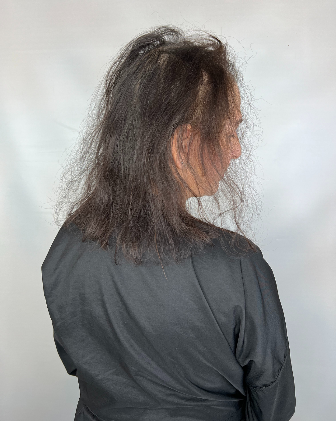 mesh integration hair loss androgenetic alopecia menopause hormonal hair loss trichotillomania thinning hair