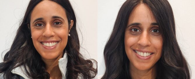 Mesh Integration Meshless integration