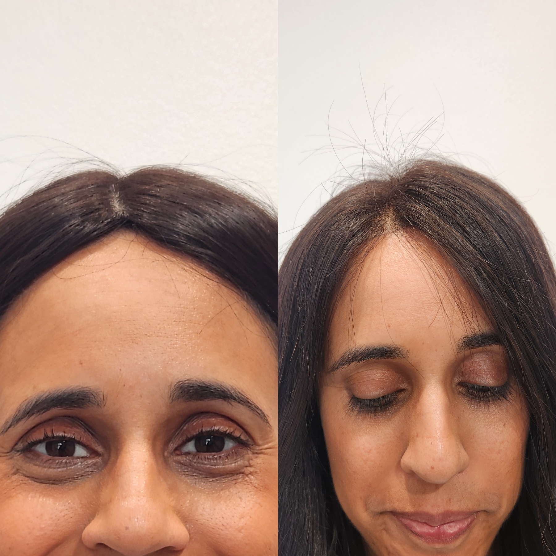 hair extensions for thinning hair