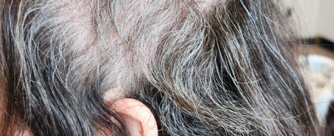 Trichotillomania