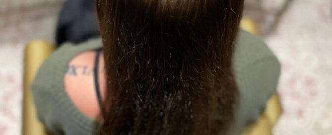 Hair loss, thinning hair, meshless integration candidate