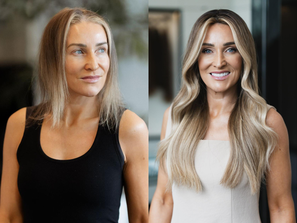 image32-before-after